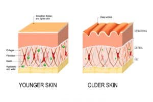 collagen/skin layers